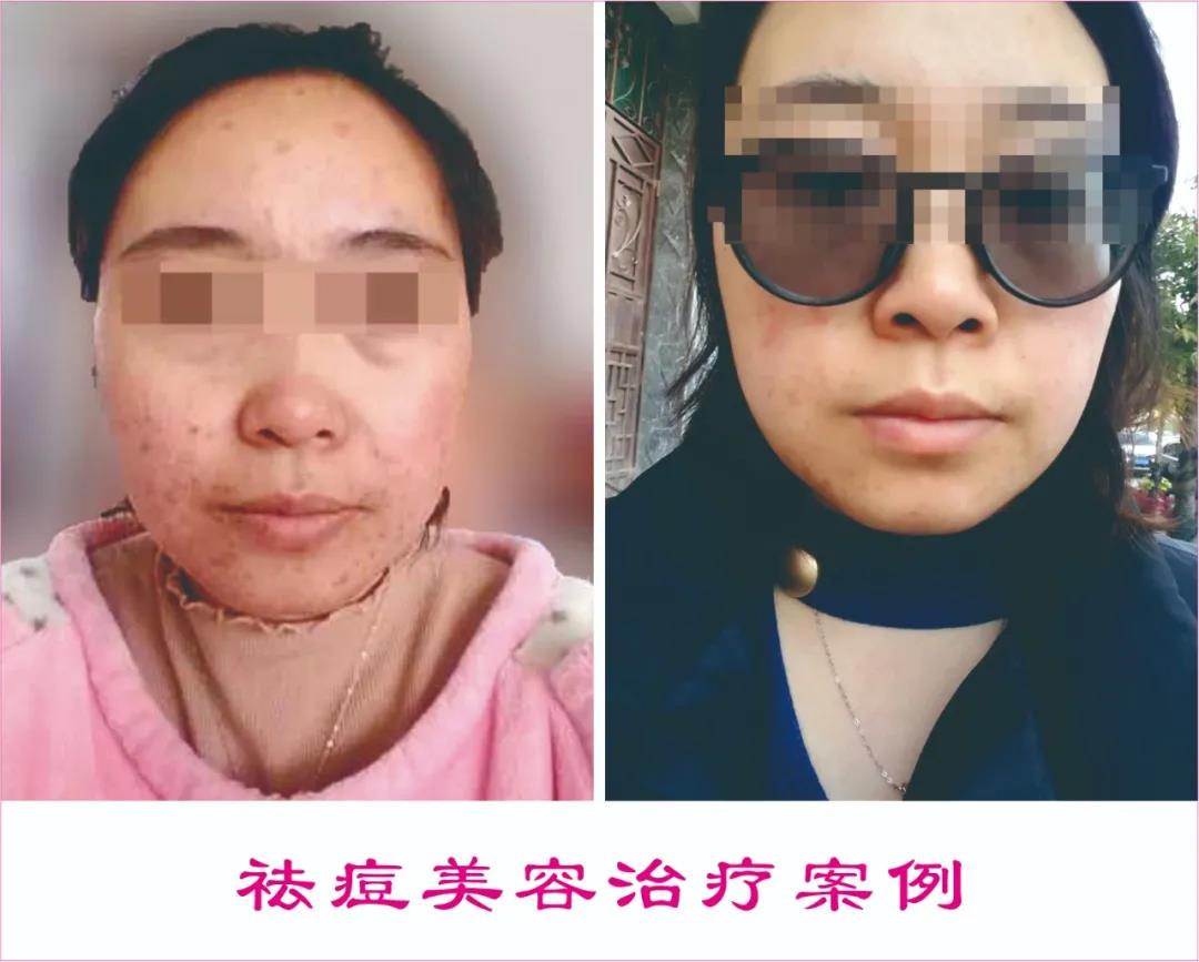 中醫(yī)駐顏，標(biāo)本兼治|中醫(yī)養(yǎng)生駐顏保健治療中心